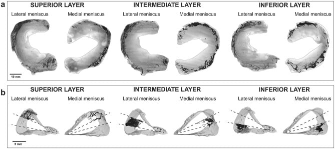 Meniscal vascularity on micro-CT