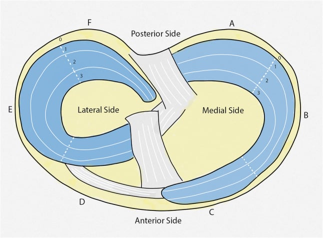 Cooper radial and circumferential meniscal zones