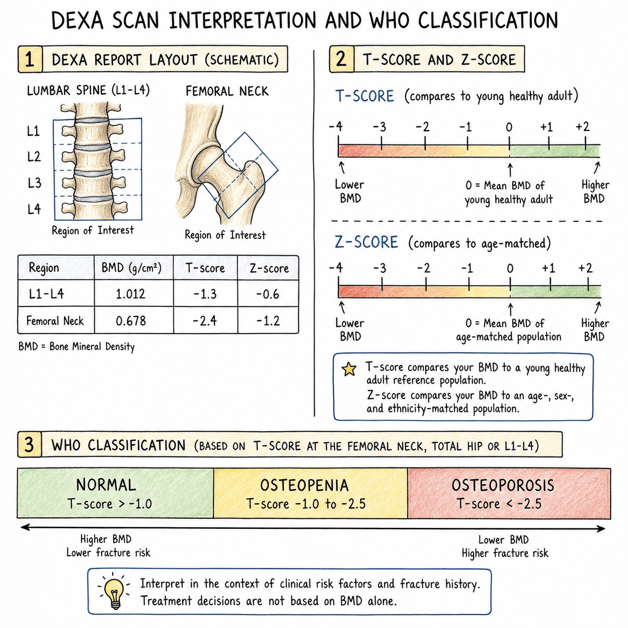 DEXA scan interpretation showing T-score, Z-score and WHO classification