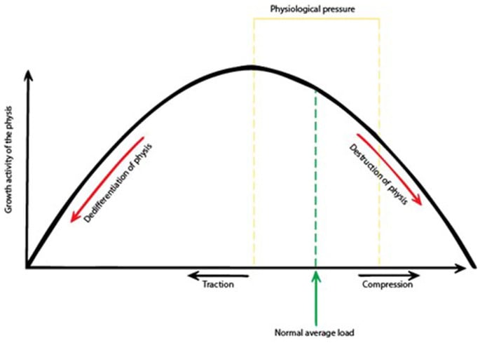 Graph of physeal growth activity against load, showing acceleration with traction and deceleration with compression