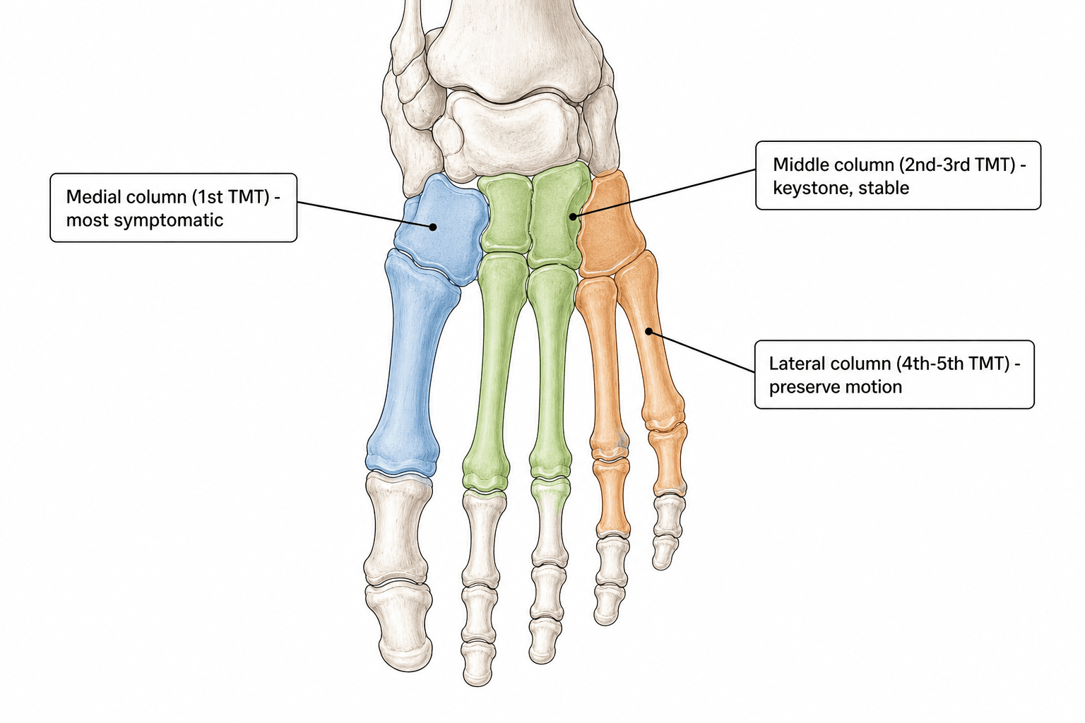 Dorsal view of the foot skeleton with the tarsometatarsal joint complex colour-coded into medial, middle, and lateral columns