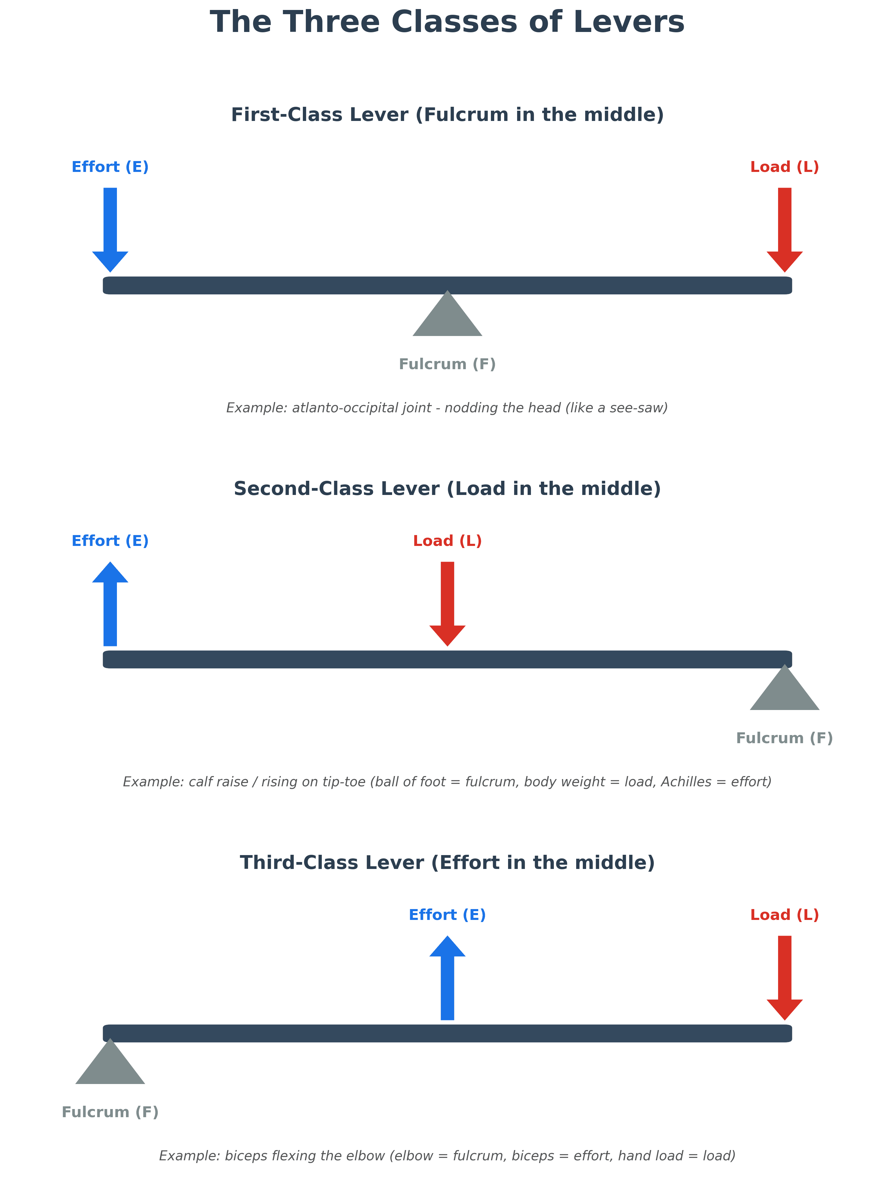 Beam diagrams of the three classes of lever showing the relative positions of fulcrum, effort and load