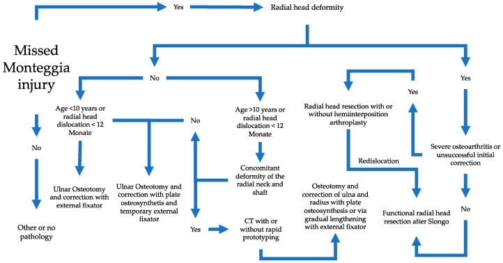 Flowchart for treatment selection in missed Monteggia injury based on chronicity and radial-head dysplasia.