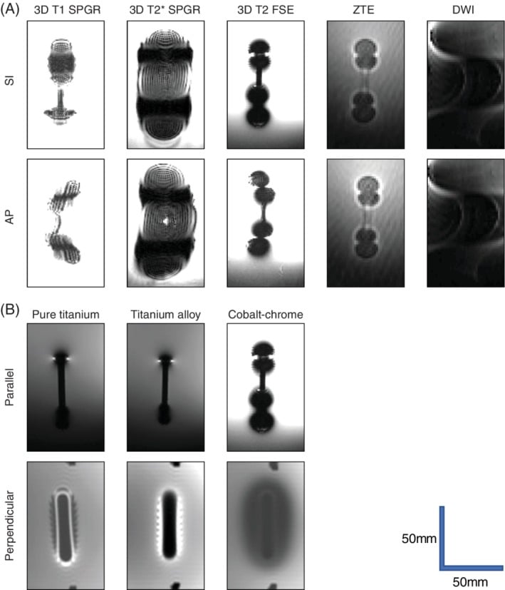 Comparison of cobalt-chrome, titanium alloy and pure titanium rods across MRI sequences and orientations.