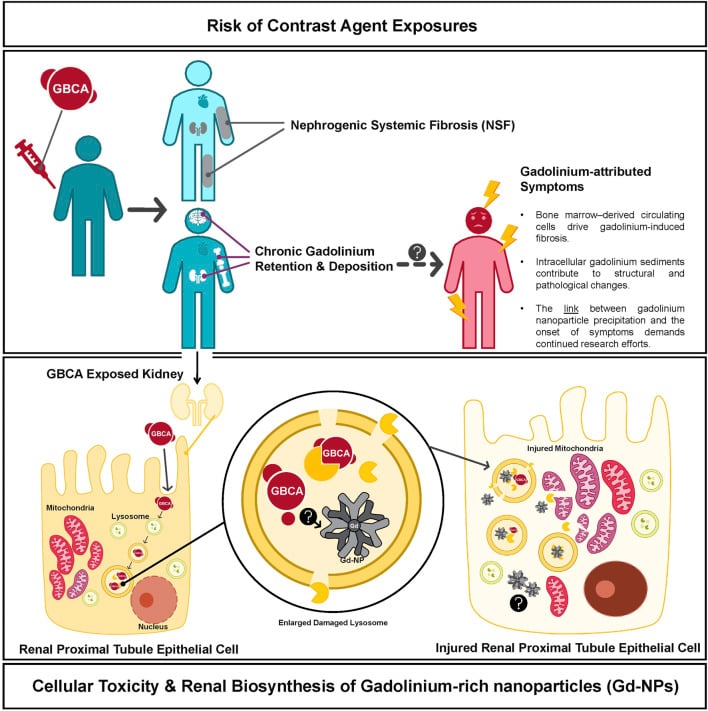 Diagram linking gadolinium exposure with nephrogenic systemic fibrosis, retention and proposed cellular injury pathways.