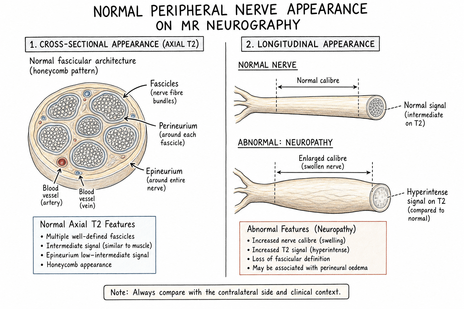 Normal peripheral nerve fascicular architecture and MR neurography appearance