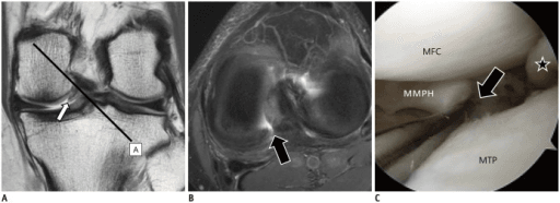 MRI sequences demonstrating different tissue contrast characteristics in orthopaedic imaging