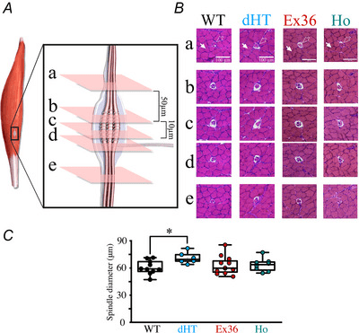 Location and internal morphology of a muscle spindle