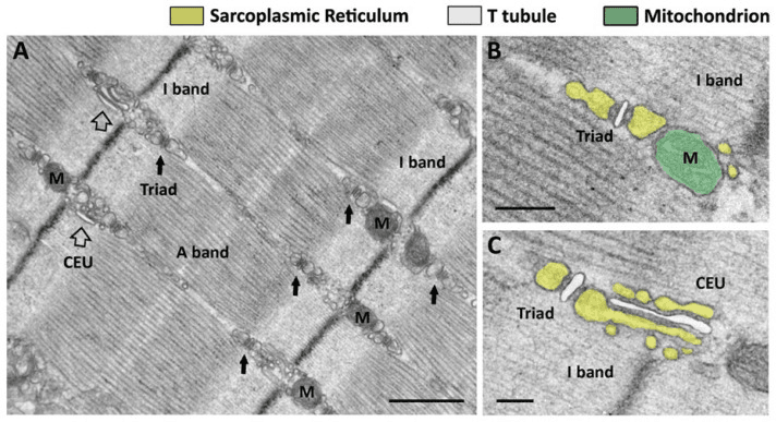 Electron microscopy of triads mitochondria and calcium-entry units