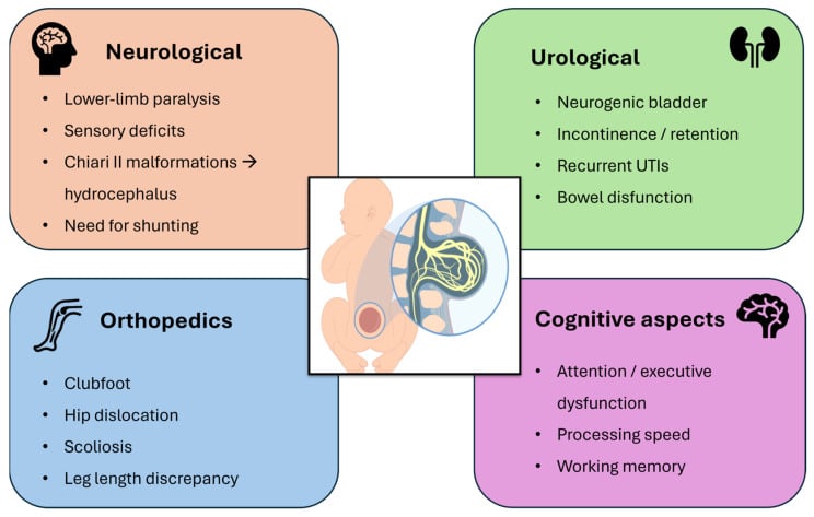 Schematic overview of neurological, urological, orthopaedic and cognitive manifestations of myelomeningocele