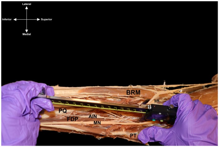 Cadaveric dissection of the median nerve and branches in the anterior forearm