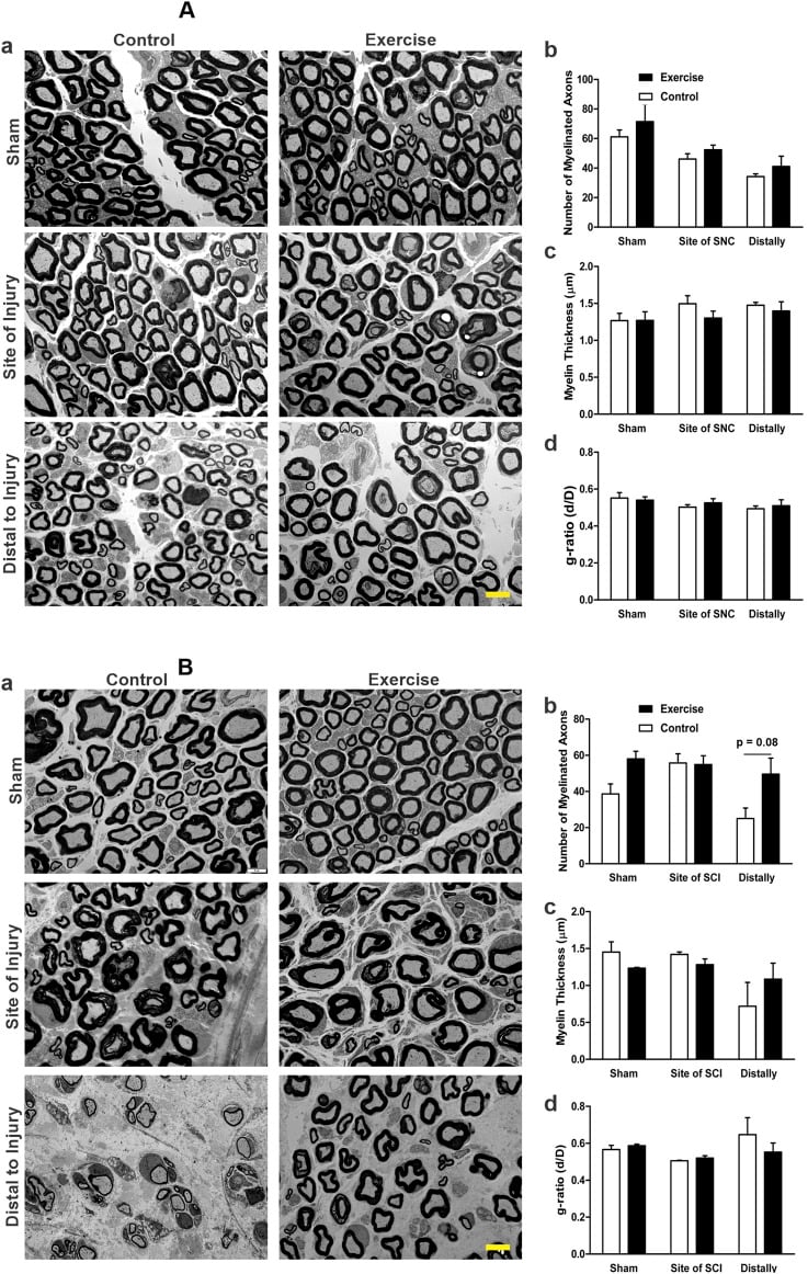 Transmission electron microscopy of peripheral nerve proximal and distal to compression injury