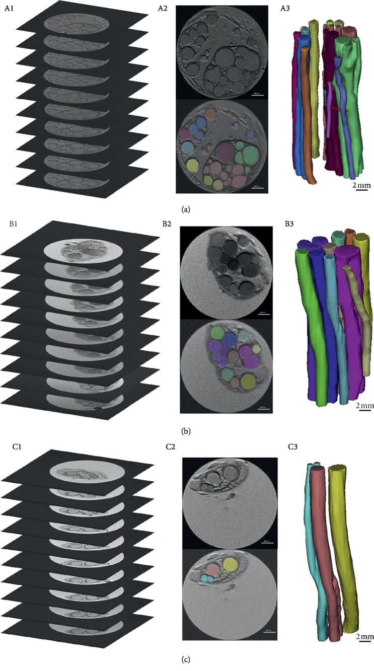 Micro-MRI and three-dimensional reconstruction of peripheral nerve fascicles