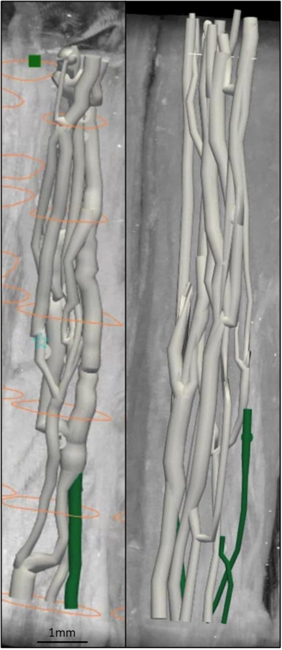 Three-dimensional reconstruction of merging and splitting fascicles in human vagus nerve
