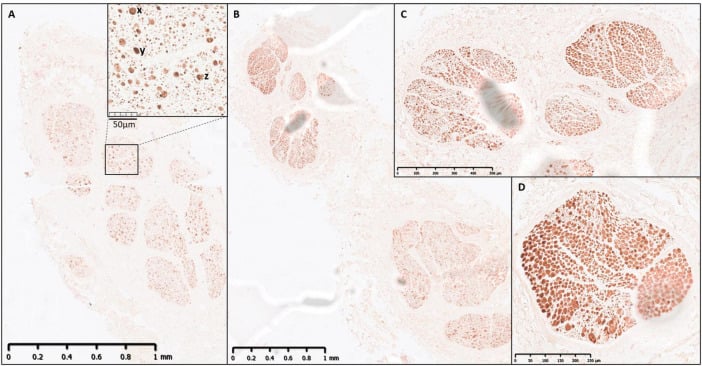 Human vagus nerve immunohistochemistry for neurofilament and myelin basic protein