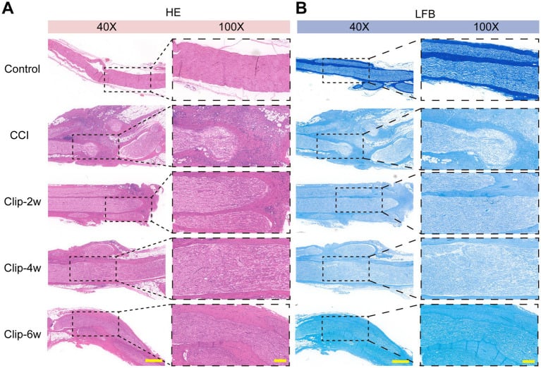 H&E and Luxol fast blue histology after graded peripheral nerve compression injury