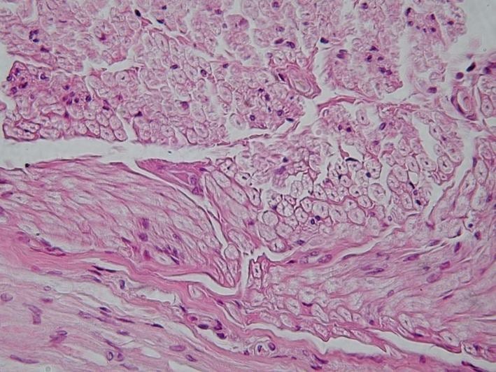 H&E histological imaging of a peripheral nerve in cross-section showing fascicles of myelinated axons bounded by perineurium and surrounding epineurium.
