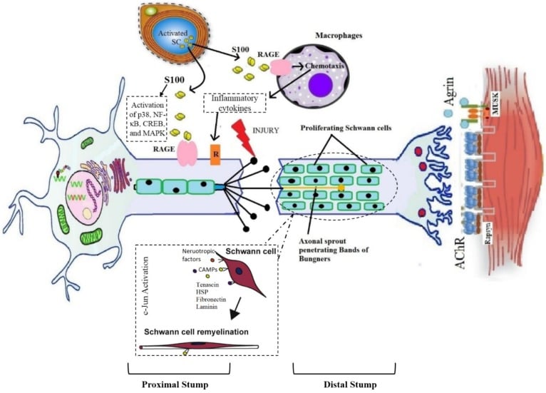 Schematic of Wallerian degeneration with Schwann-cell activation, macrophage recruitment, bands of Bungner and axonal sprouting
