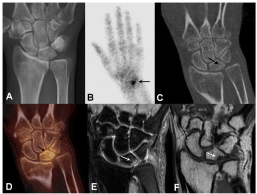 Multimodal wrist imaging panel including planar bone scintigram and SPECT/CT fusion