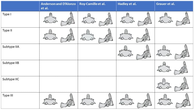 Matrix comparing Anderson-D'Alonzo, Roy-Camille, Hadley and Grauer odontoid fracture classifications