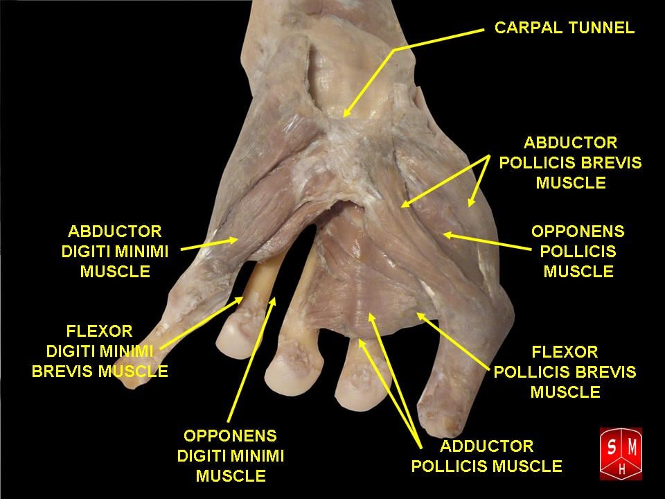 Illustration of the palm with the thenar and hypothenar muscles labelled, opponens pollicis lying deep in the thenar eminence.