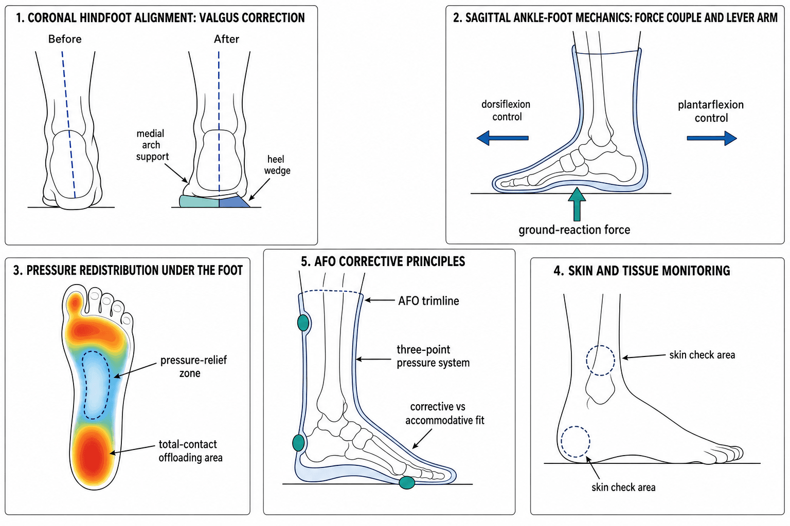 Labelled schematic of ankle-foot orthosis biomechanics and interface principles