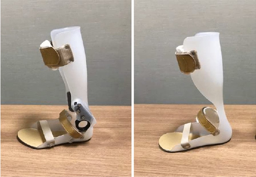 Side-by-side photographs of an articulated oil-damper AFO (left) and a nonarticulated AFO (right).