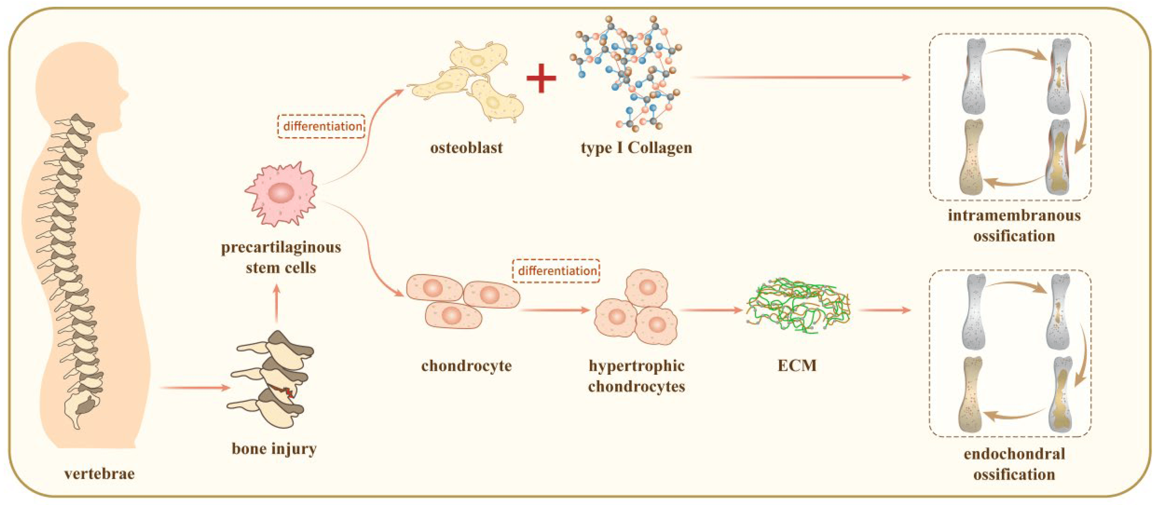 Scheme in which precartilaginous stem cells, after a vertebral bone injury, differentiate either into osteoblasts with type I collagen (intramembranous ossification) or into chondrocytes, hypertrophic chondrocytes and extracellular matrix (endochondral ossification)