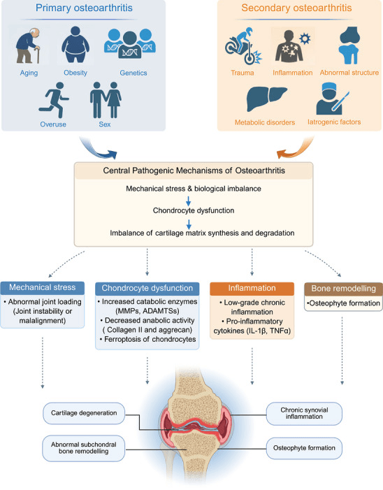Primary and secondary osteoarthritis drivers and whole-joint consequences