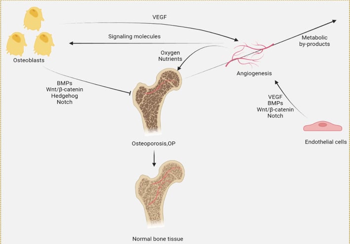 Schematic of angiogenesis-osteogenesis coupling showing osteoblasts, endothelial cells, VEGF, BMPs, Wnt and Notch signalling with normal bone contrasted against osteoporotic bone