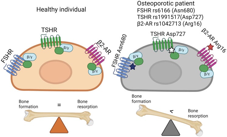 Comparison of receptor signalling on the osteoblast in a healthy individual and in an osteoporotic patient carrying FSHR, TSHR and beta-2 adrenoreceptor variants, with the formation-resorption balance shown as a see-saw