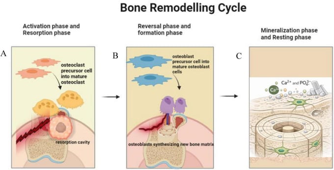 Three-stage diagram of the bone remodelling cycle showing activation and resorption, the reversal and formation phase, and mineralisation with resting