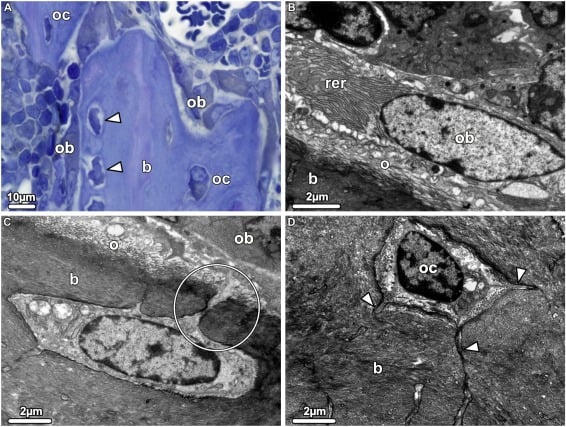 Light microscopy and transmission electron microscopy of the transition from osteoblast to osteocyte.