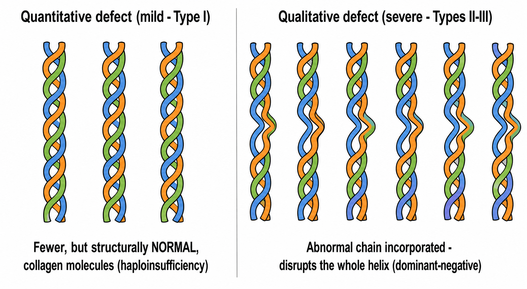 Diagram comparing a quantitative collagen defect with fewer normal triple helices against a qualitative defect with a structurally abnormal, distorted triple helix