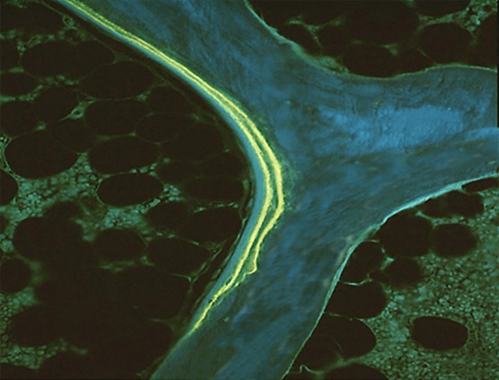 Normal double tetracycline labels at a mineralisation front