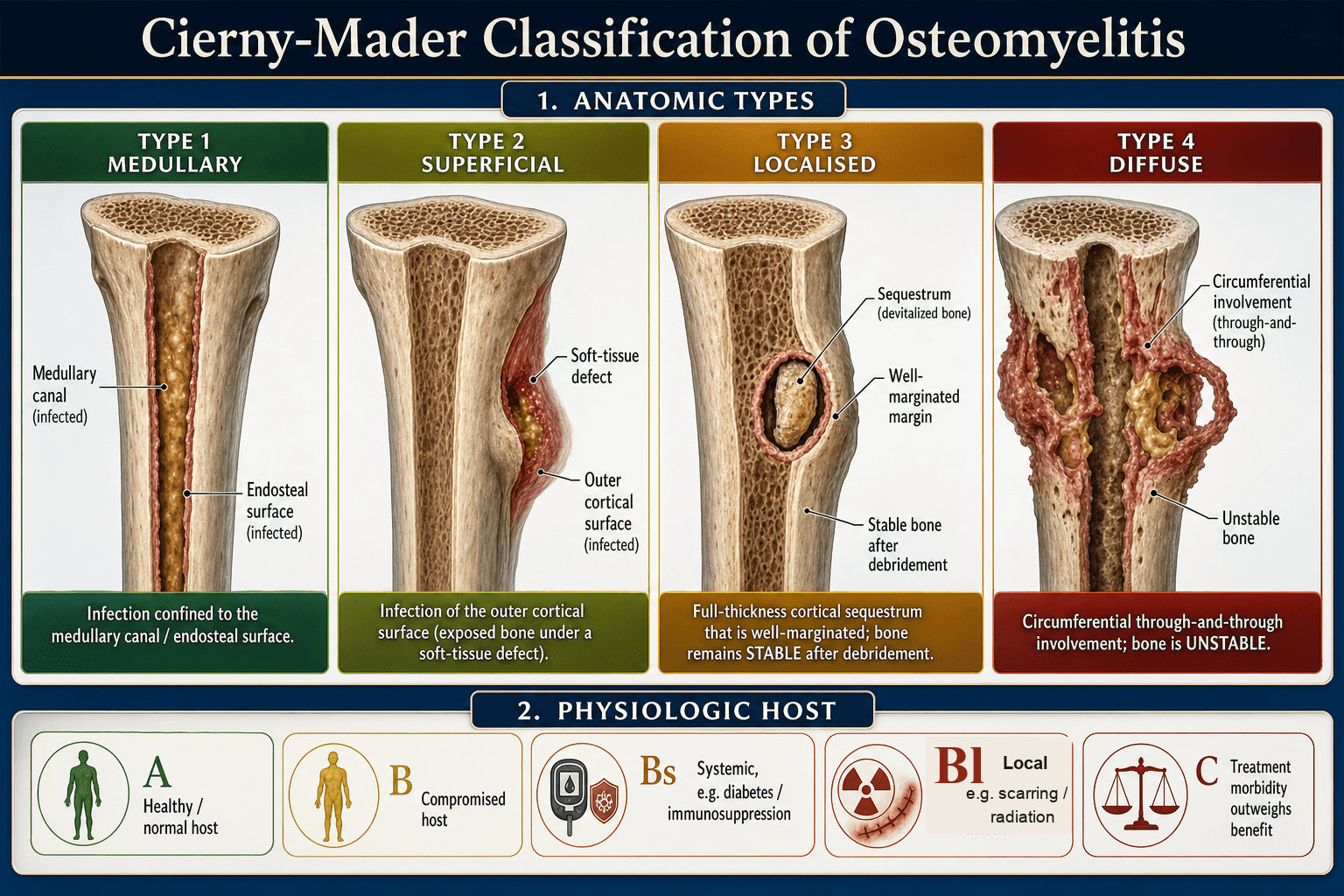Cierny-Mader classification of osteomyelitis
