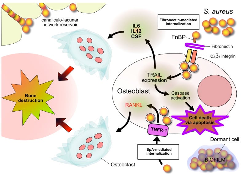 Diagram of Staphylococcus aureus internalisation into osteoblasts, intracellular dormancy, osteoclast activation and bone destruction.