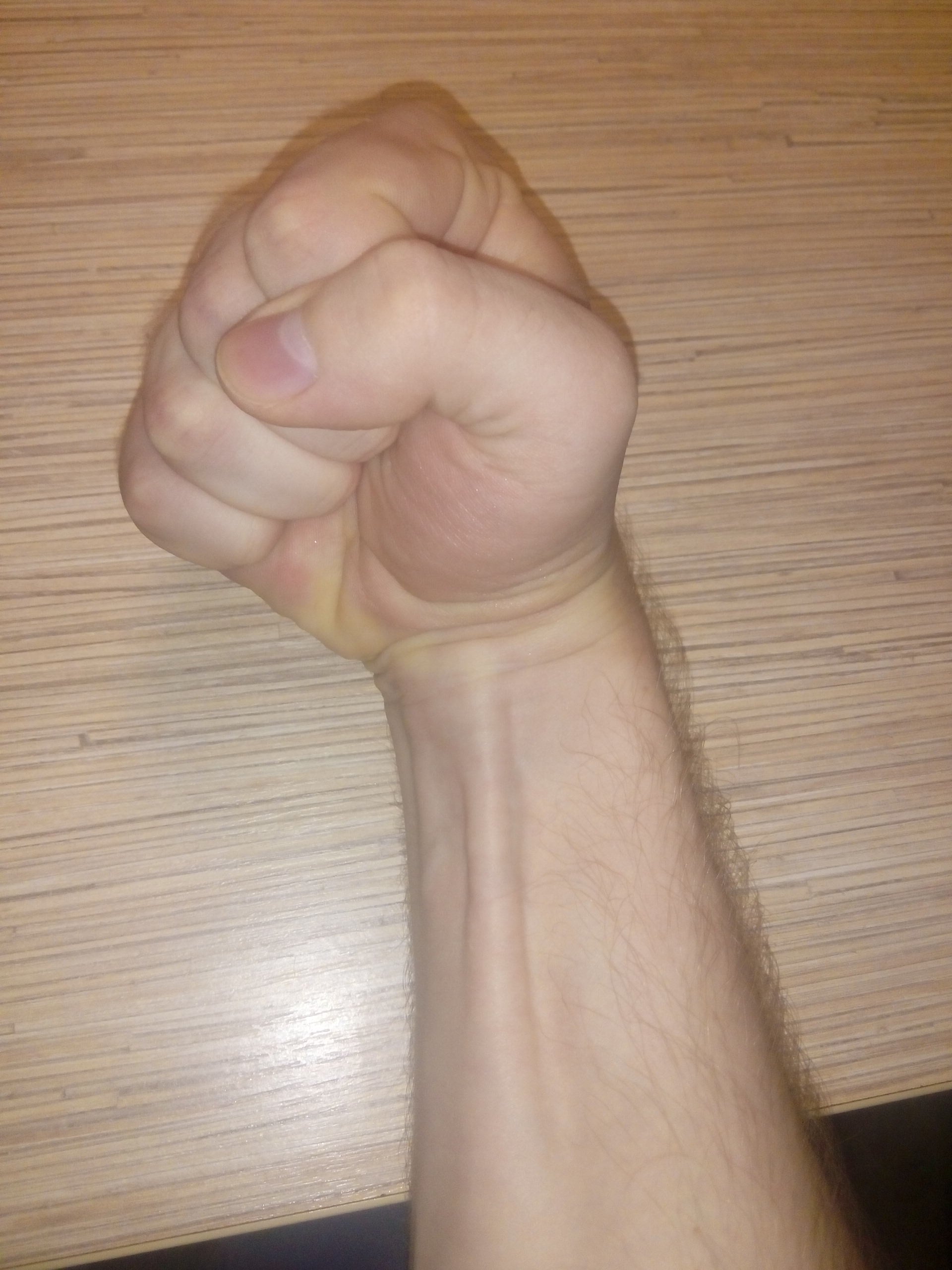 Anterior forearm illustration with the long, slender palmaris longus muscle and its tendon highlighted.