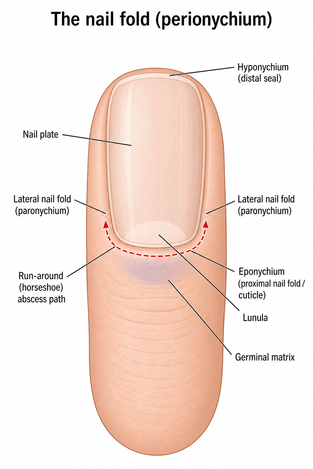 Labelled dorsal diagram of the nail unit showing the nail plate, eponychium (proximal nail fold), lateral nail folds (paronychium), hyponychium, lunula and germinal matrix, with a curved arrow showing the run-around abscess path