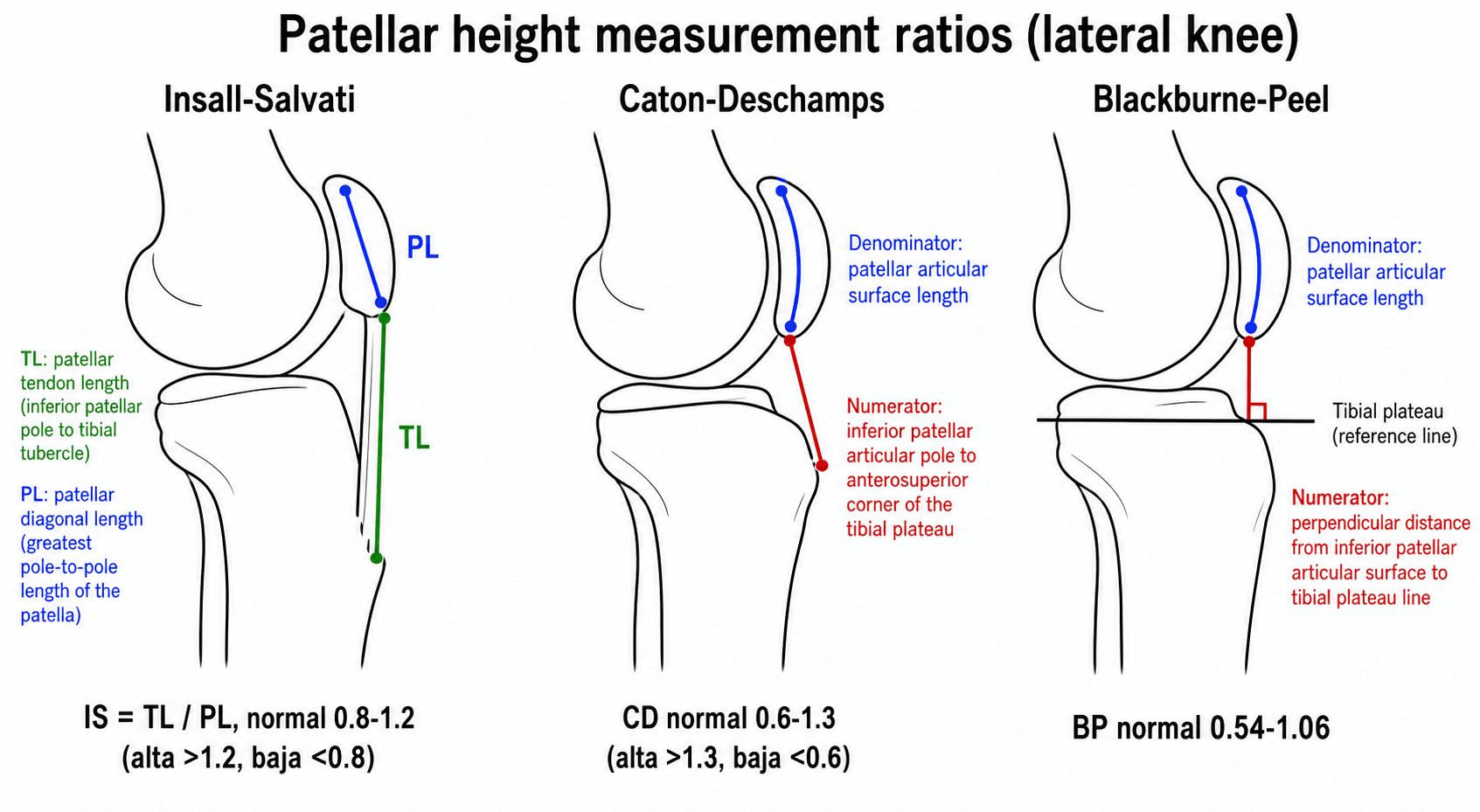 Three-panel schematic of the Insall-Salvati, Caton-Deschamps and Blackburne-Peel patellar height ratios on a lateral knee
