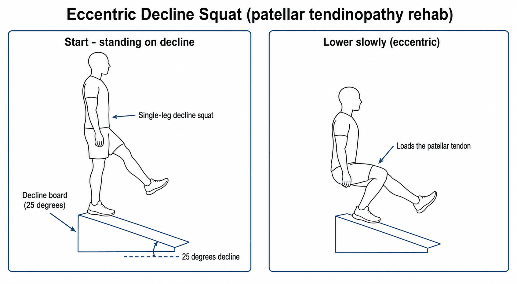Diagram of a single-leg decline squat on a 25-degree board for patellar-tendon loading.