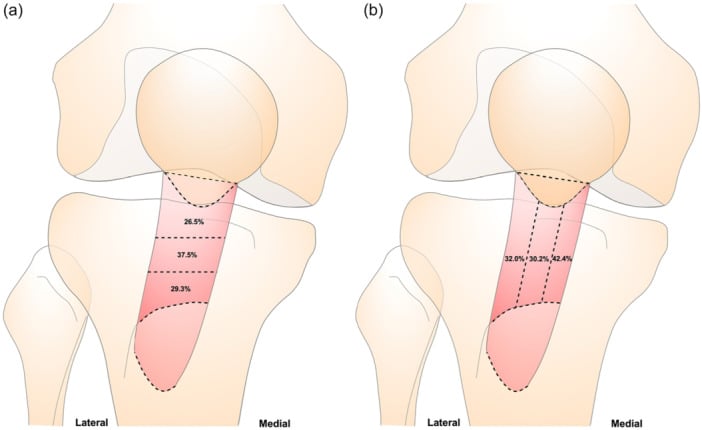 Diagram of relative arterial contributions to proximal, central, distal, medial and lateral patellar tendon regions.