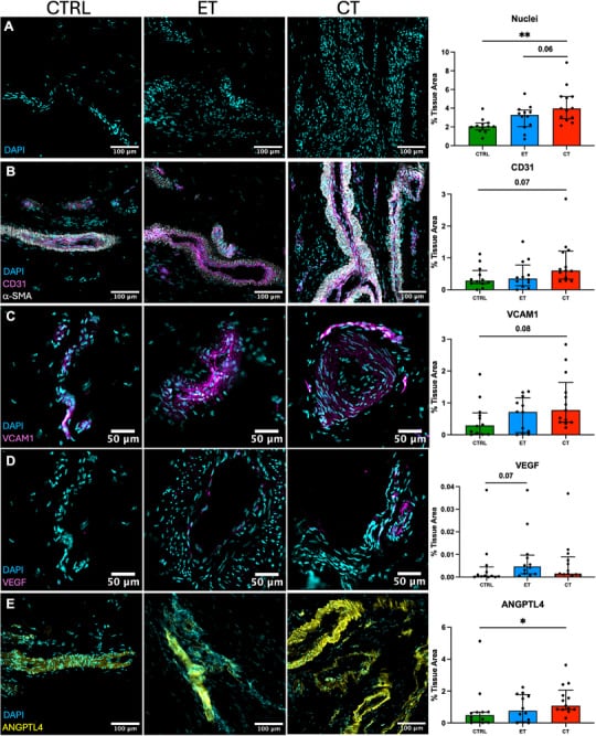Immunofluorescence microscopy comparing vascular markers in healthy, early and chronic patellar tendinopathy.