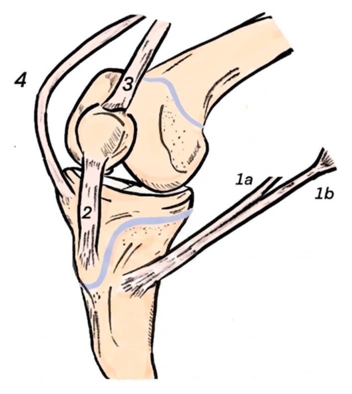 Oblique knee schematic showing hamstring, patellar-tendon, quadriceps-tendon and iliotibial-band graft options around open physes