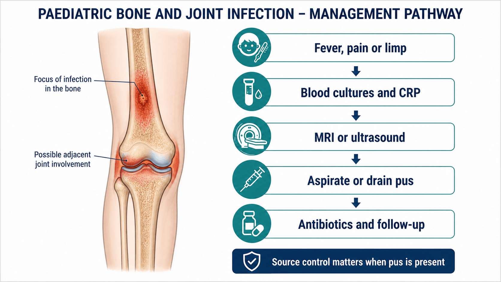 Paediatric bone and joint infection management pathway showing fever pain limp, blood cultures and CRP, MRI or ultrasound, aspiration or drainage, antibiotics and follow-up