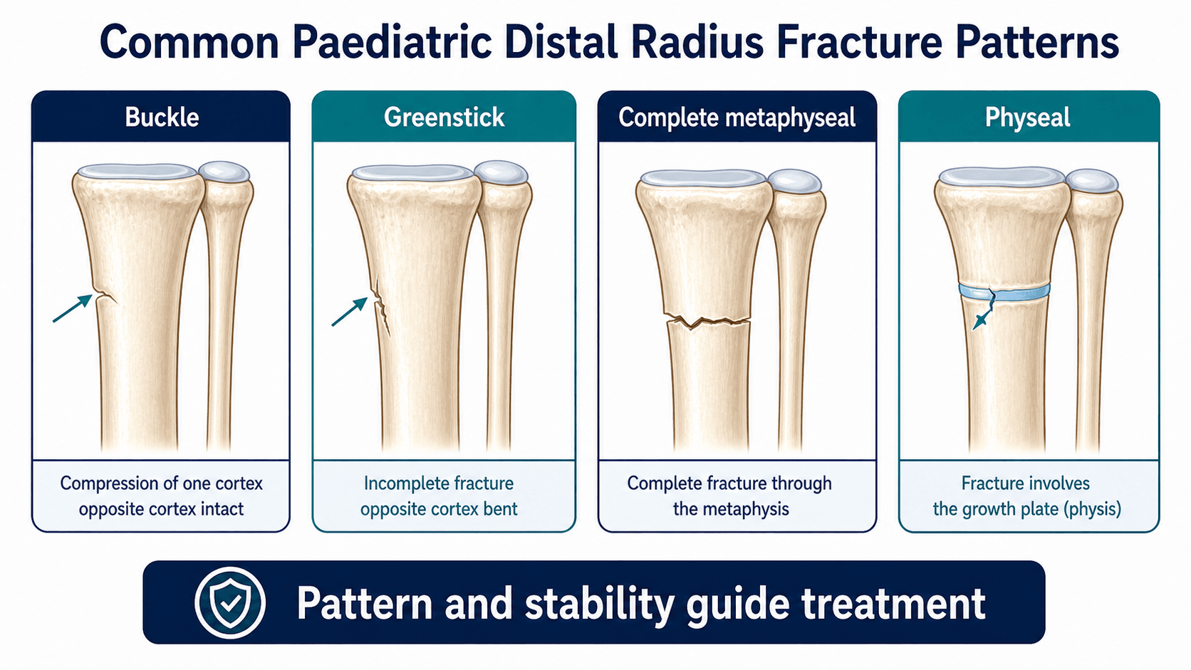 Paediatric distal radius fracture classification diagram showing buckle, greenstick, complete metaphyseal and physeal patterns