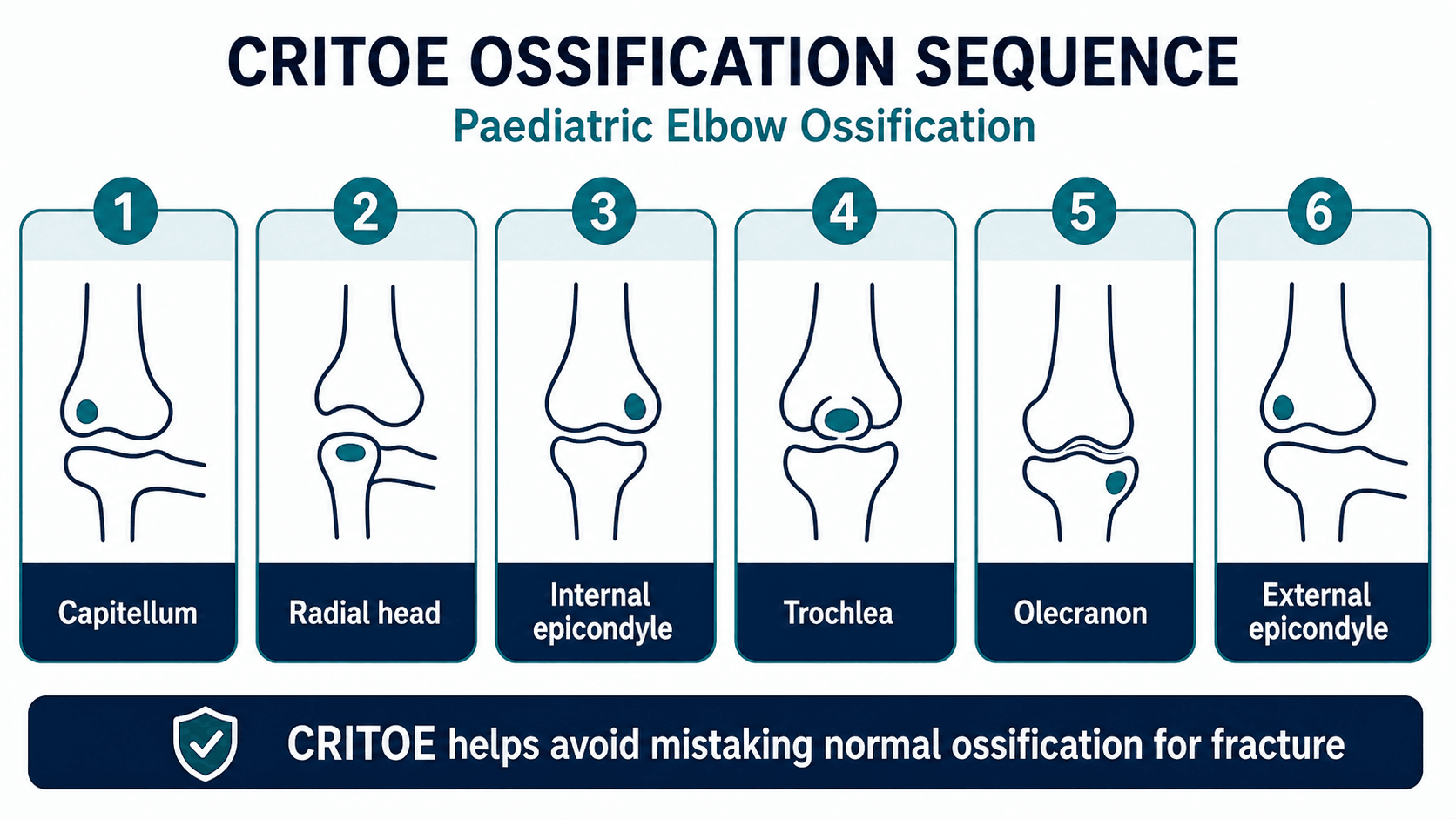 Paediatric elbow CRITOE ossification sequence showing capitellum, radial head, internal epicondyle, trochlea, olecranon and external epicondyle