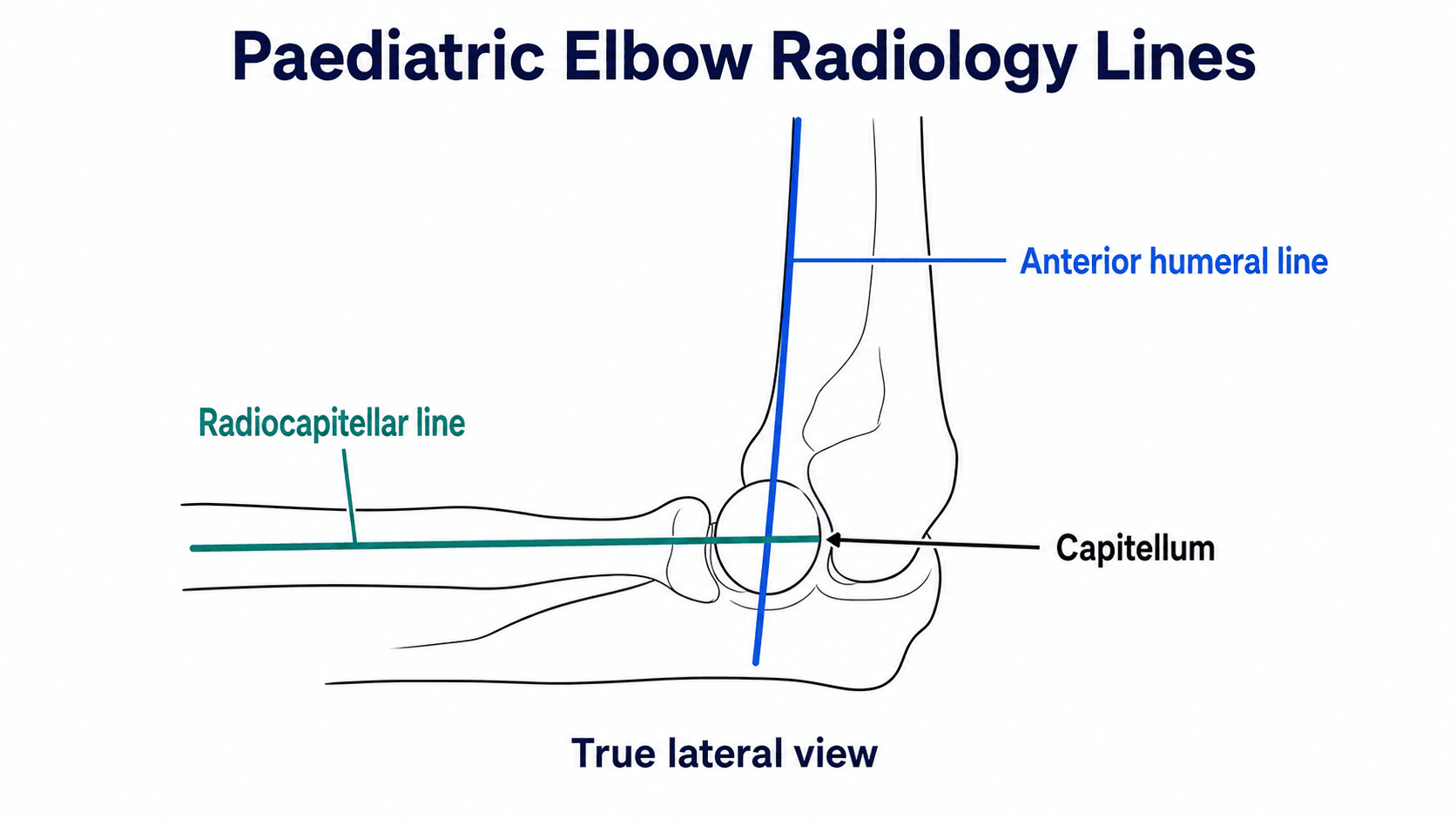 Paediatric elbow radiology lines diagram