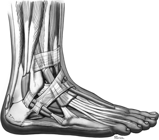 Lateral ankle illustration showing superior peroneal retinaculum and peroneal tendon courses