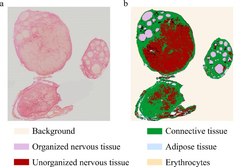 Whole-slide elastica van Gieson stained nerve section alongside a segmented image colour-coding organised nervous tissue, unorganised nervous tissue, connective tissue and adipose tissue